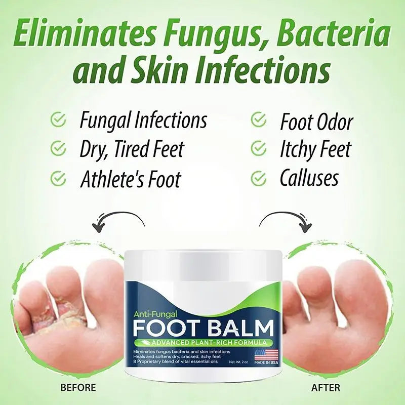 MenoMode natural foot balm for dry skin with antifungal formula showing before and after treatment of fungal infections and dry feet