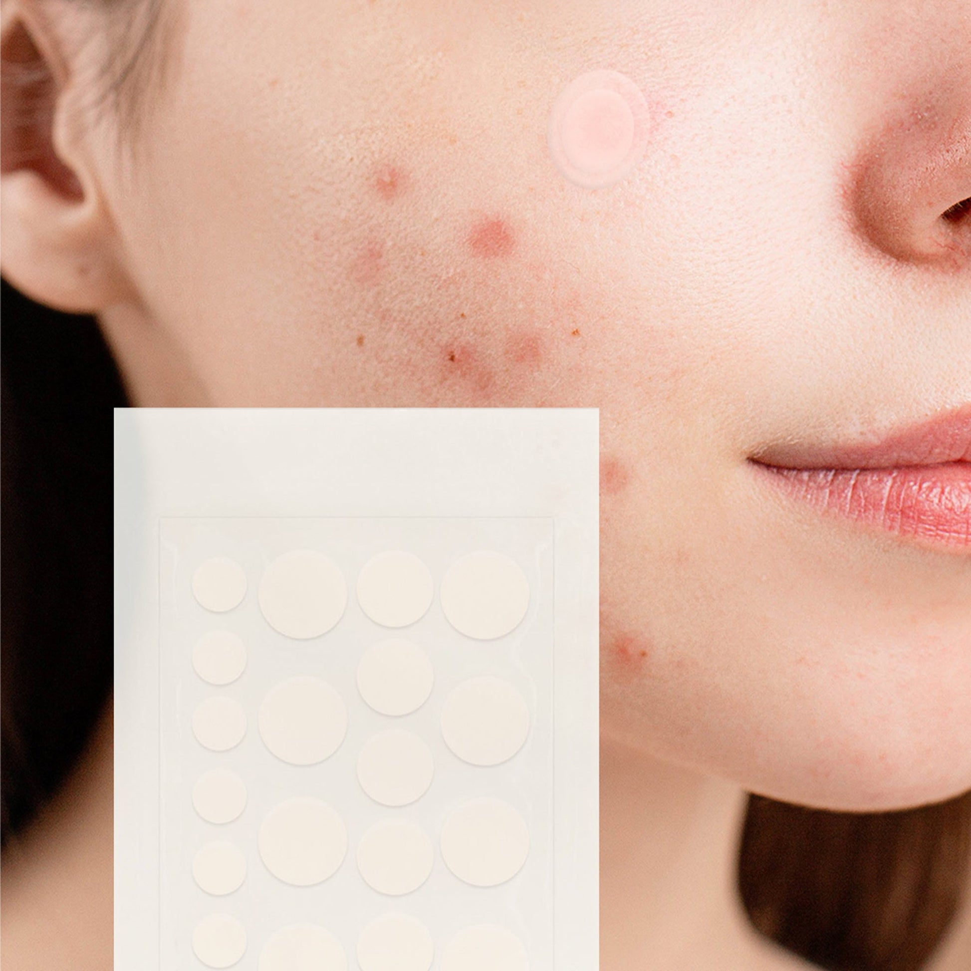Close-up of a woman with acne showing the best pimple patch for menopause on her cheek by DC-PURSONIC