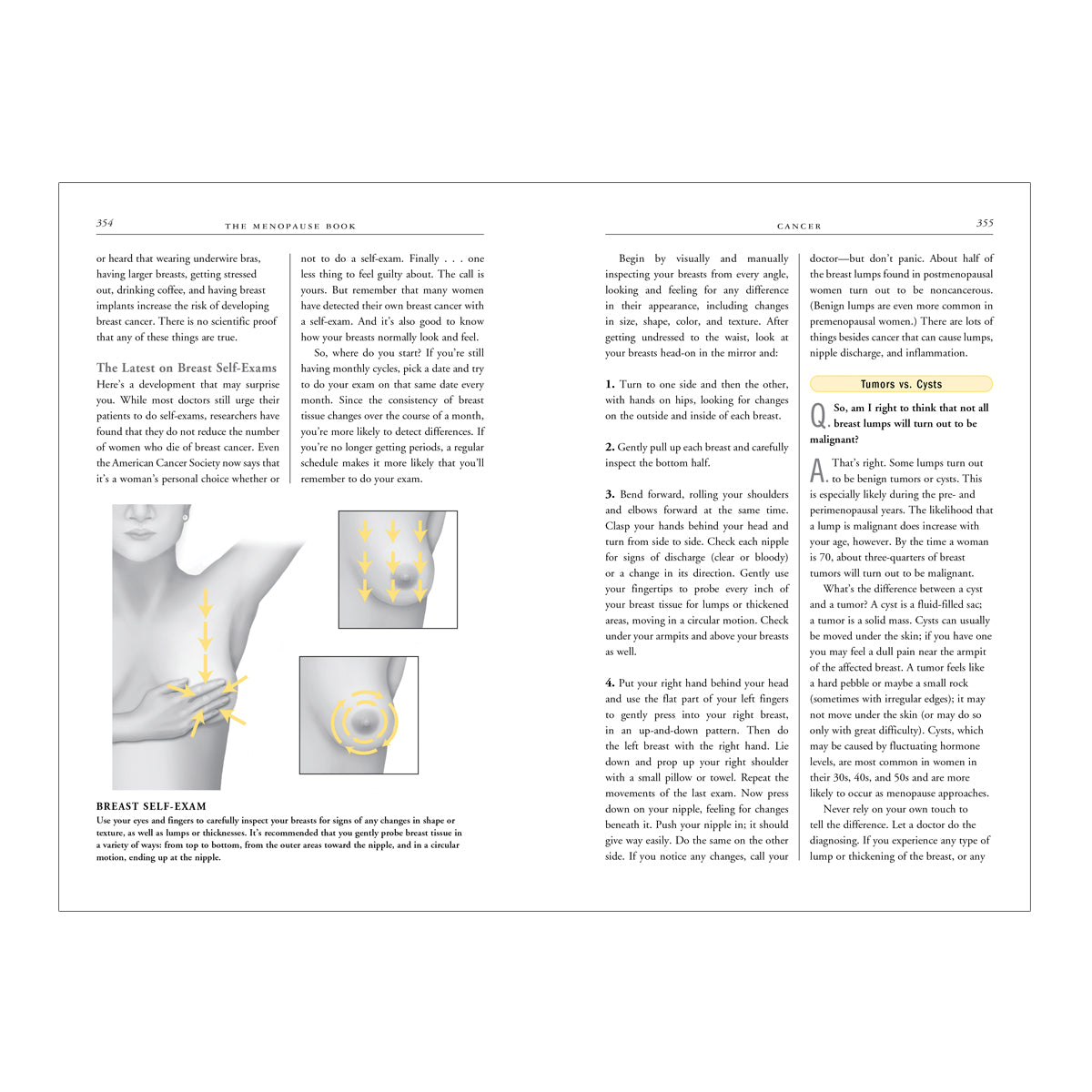 Open menopause guide book by Hachette showing breast self-exam instructions and menopause-related health information