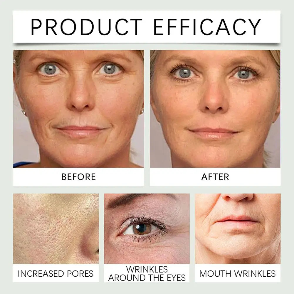Before and after images showing skin improvement using hormone balancing cream for women by MenoMode